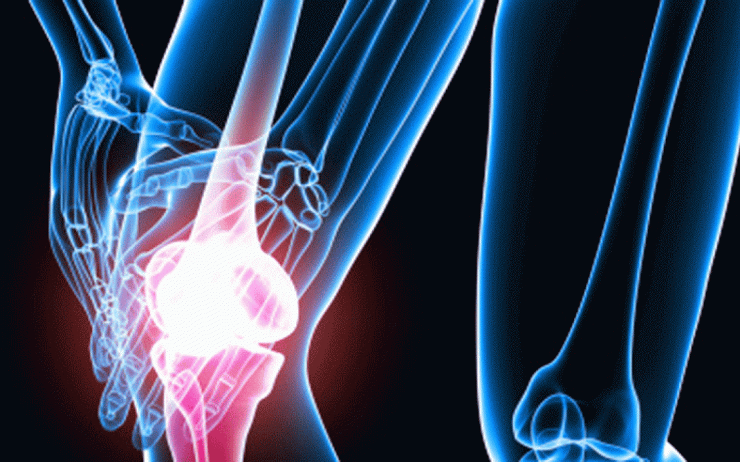 Protege tus huesos y articulaciones con colágeno hidrolizado – Parte I