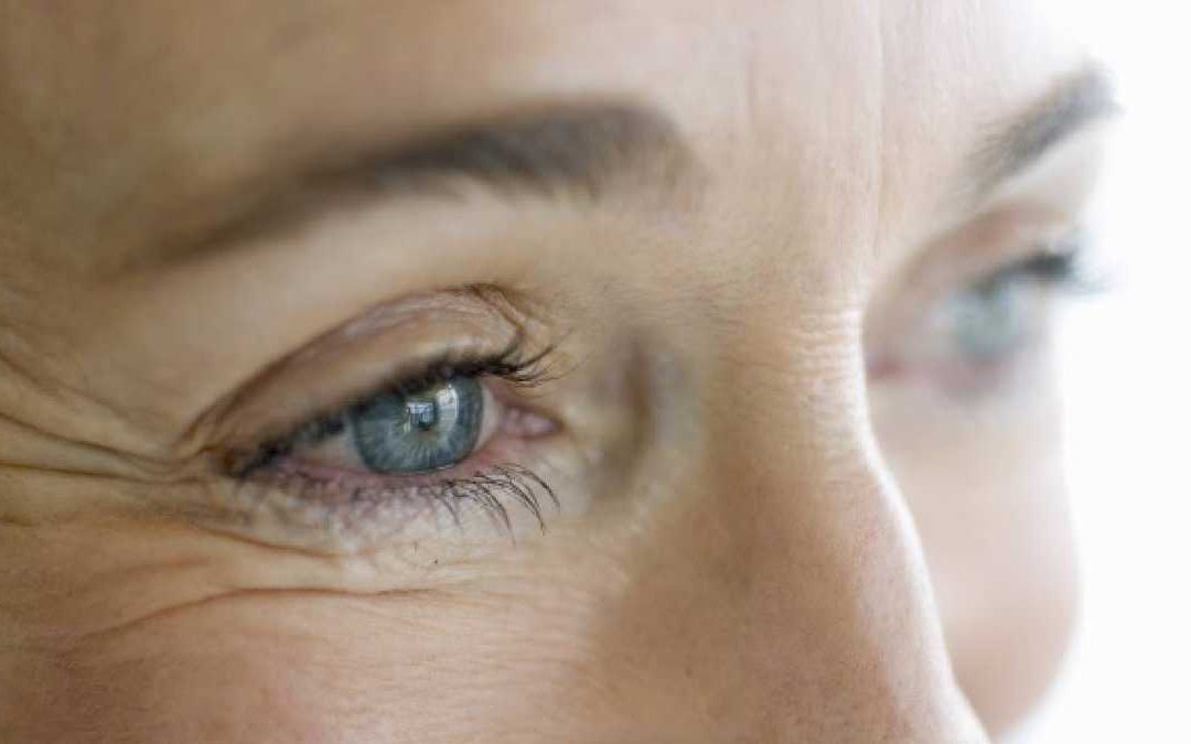 Arrugas: como prevenirlas y atenuarlas.